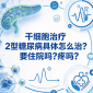 干细胞治疗2型糖尿病具体怎么治?要住院吗?疼吗?